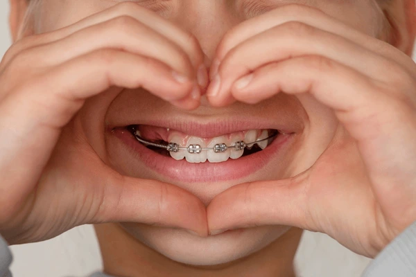 dental-braces-on-baby-teeth-600nw-2705861935
